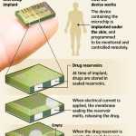 cip implantat