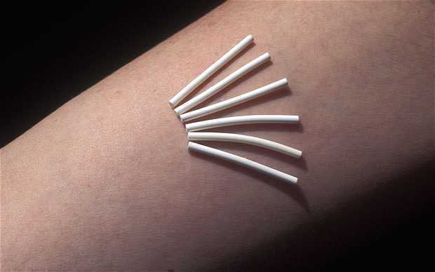 contraceptive-implant